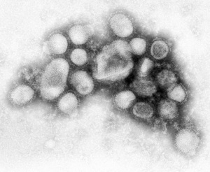 Photo: CDC Influenza Laboratory